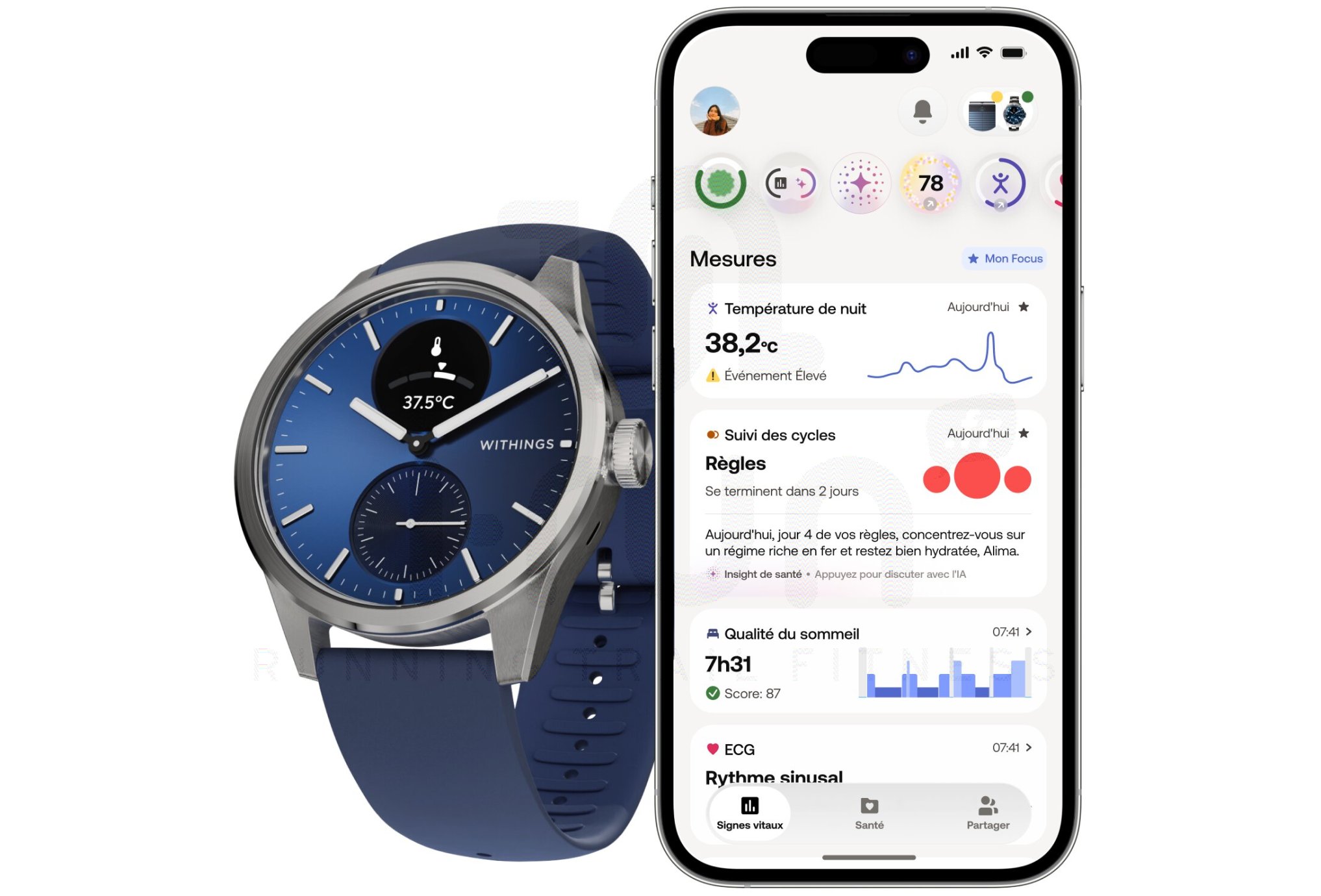 Withings ScanWatch 2 42 mm